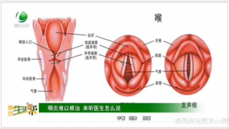 咽炎难以根治 来听医生怎么说